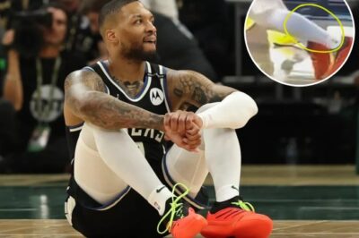 New Gruesome Slo-Mo Video Shows Close-Up Of Something Popping In Damian Lillard’s Leg, And It Does Not Look Good