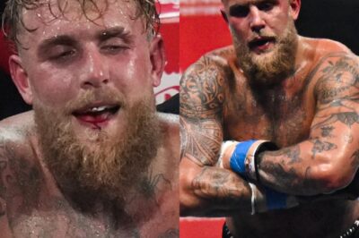 [VIDEO] Jake Paul’s Shocking One-Word Response to Letting Someone Break His Jaw for $92M Is Going Viral – Liquid Diet Hell for 7 Days Exposed