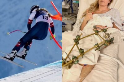 Lindsey Vonn’s Surgeon Warns About Possible Risk For Amputation, Says No. 1 Goal Right Now Is To “Keep Her Leg” In Shocking Update