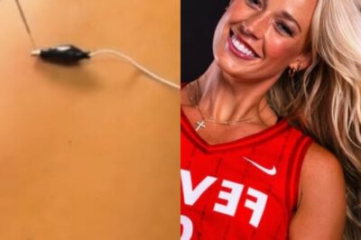 Sophie Cunningham Gives Fans Another Behind-The-Scene Look At Her Rehab [VIDE0]